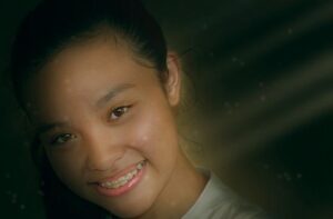 Teeth Pulled for Braces: Orthodontic Preparations for Alignment