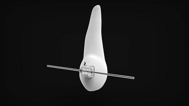 Can You Get Braces Before Wisdom Teeth Removal? Dental Considerations