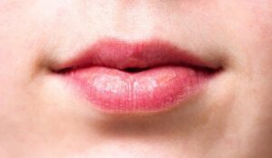 Dry Mouth After Wisdom Teeth Removal: Tips for Relief