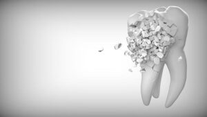 Dentist Tooth Removal Cost: Dental Expense Overview