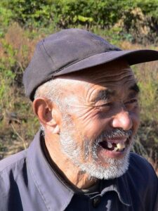 Does Affordable Dentures Pull Wisdom Teeth? Important Info!