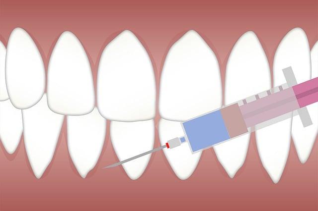 Anesthesia Pulling Teeth Piano: Musical Interpretation of Dental Procedures!