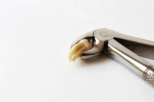 Can You Use Orajel After Wisdom Tooth Removal? Post-Extraction Tips!