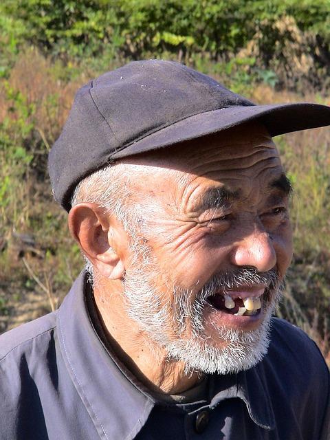 Average Cost to Get Teeth Pulled and Dentures: Financial Considerations!