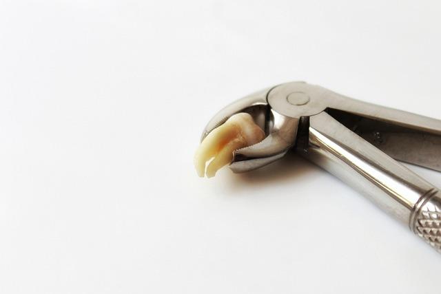 How Long After Tooth Extraction Can I Remove Gauze? Post-op Care