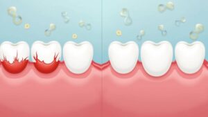 DC Wisdom Tooth Extraction Surgeon: Specialized Care 6 dental3 (AI Generated Image)