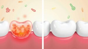 dental5 (AI Generated Image)
